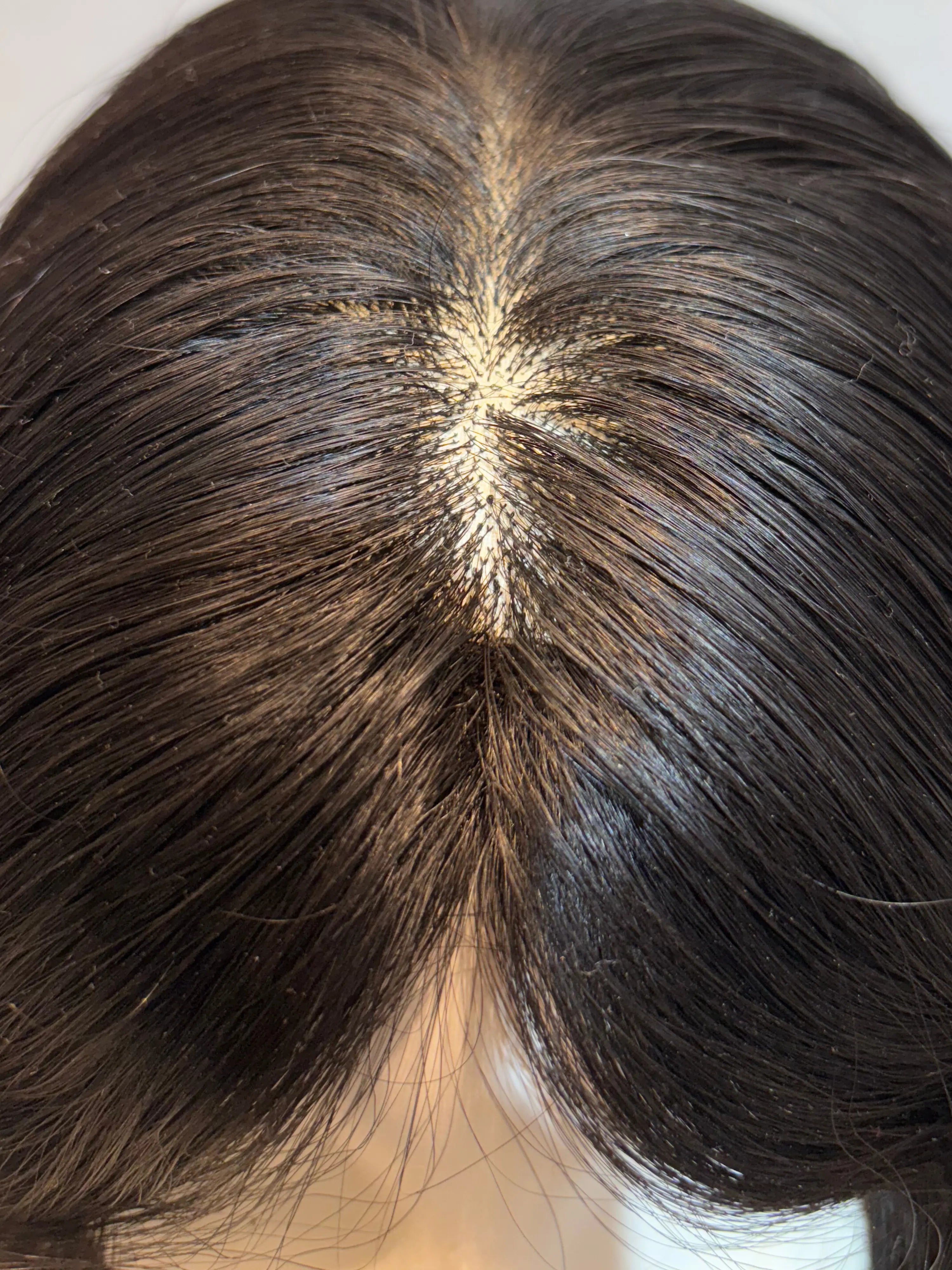 Mono Base Wig - 100% Remy Human Hair | Breathable & Natural Scalp Appearance